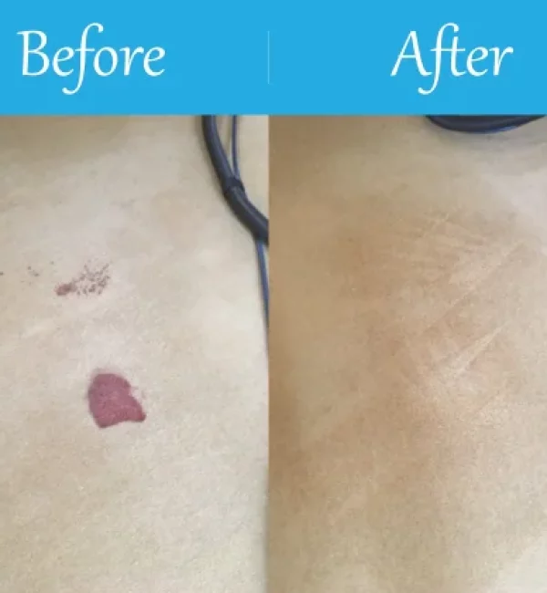 Berkshire Carpet Cleaning 10